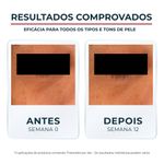 creme clareador para área dos olhos eucerin anti-pigment 15ml