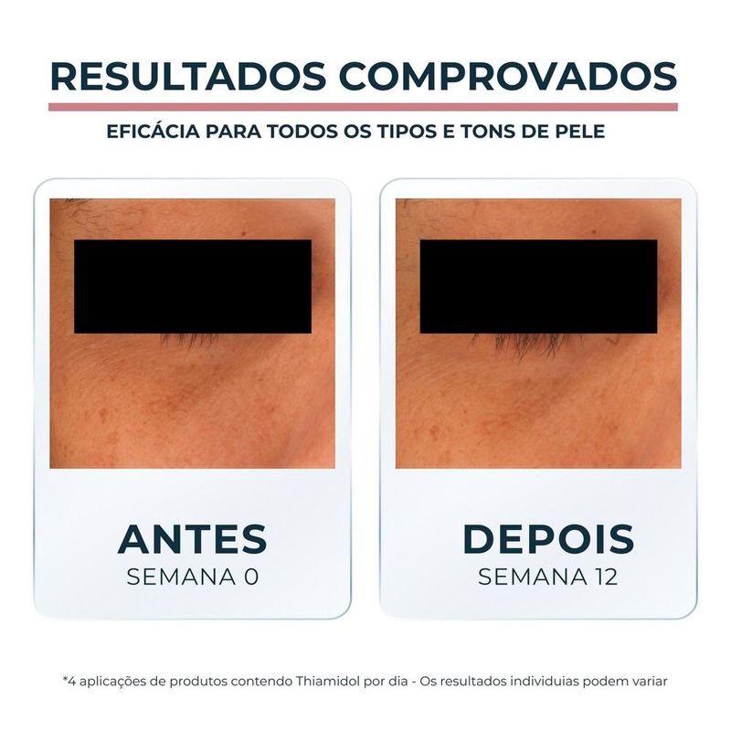 creme clareador para área dos olhos eucerin anti-pigment 15ml