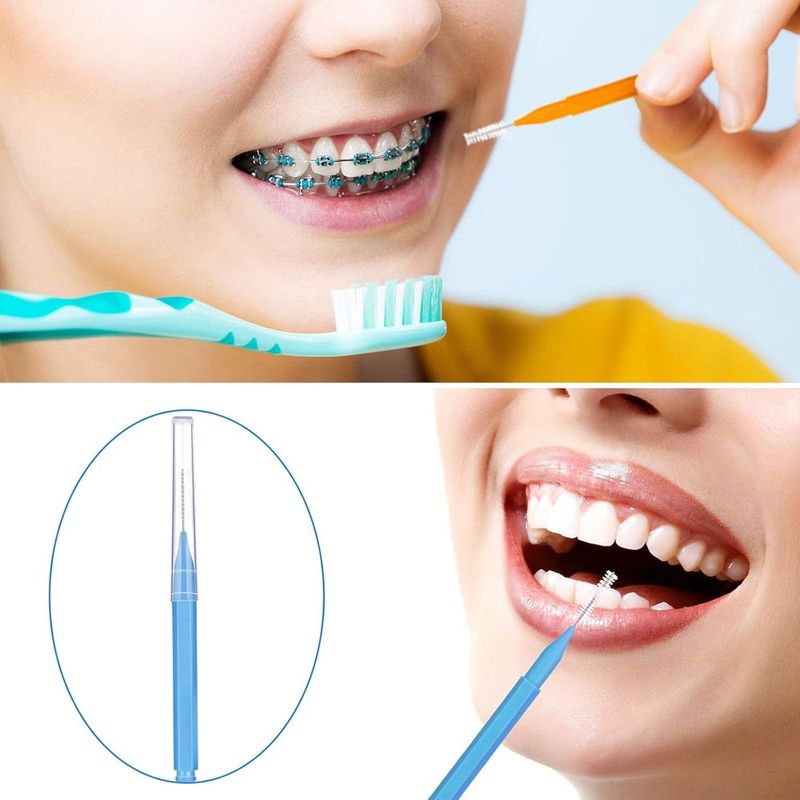 escova interdental patelai com 100 unidades a-bi