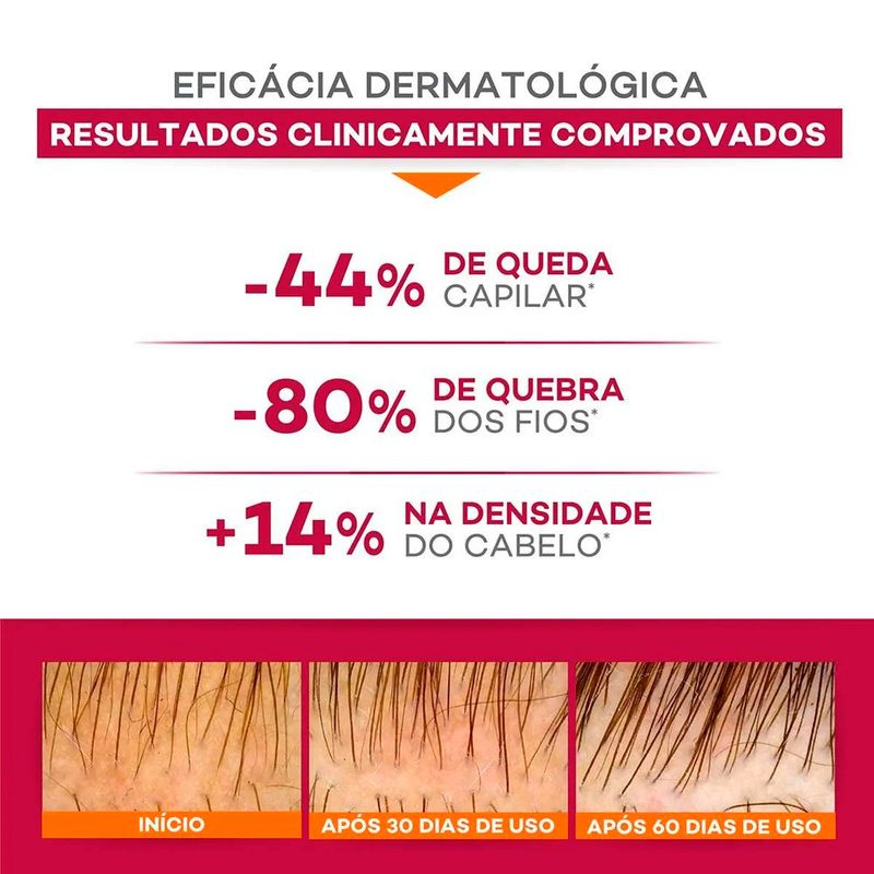shampoo antiqueda darrow doctar force 400ml