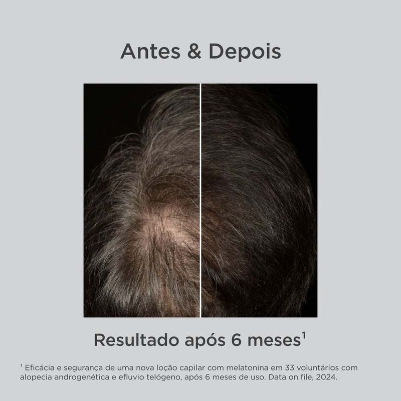 loção antiqueda isdin haircare melatonin concentrate spray 100ml