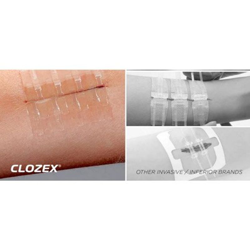 curativo de emergência clozex com 3 fechos a-mbi
