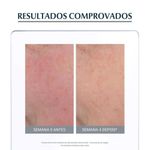 creme hidratante facial eucerin anti rednsee fps 25 50ml
