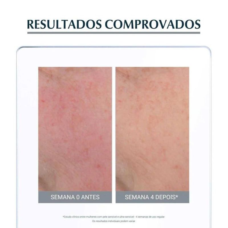 creme hidratante facial eucerin anti rednsee fps 25 50ml