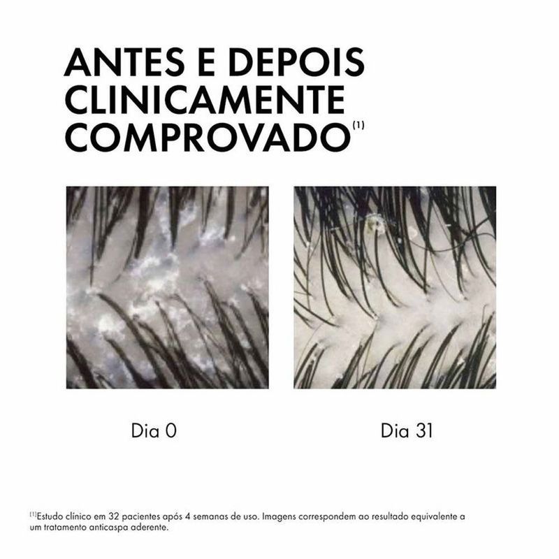 sérum 10 vichy dercos anticaspa 100ml