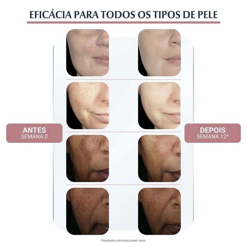 creme facial clareador eucerin anti-pigment dia fps30 50ml