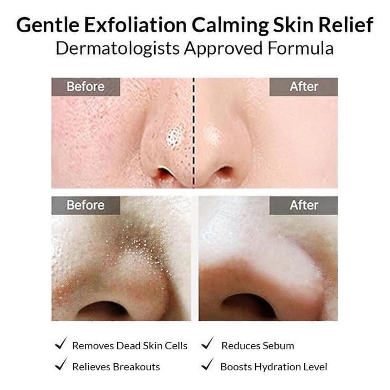 disco facial coreano celimax ji woo gae heartleaf bha peeling pad 60 unidades